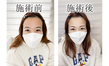 ROAK（ローク）施術例　アイブロウ例2