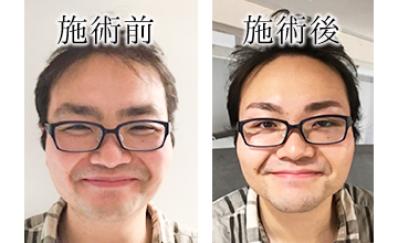 ROAK（ローク）施術例　メンズアイブロウ例1