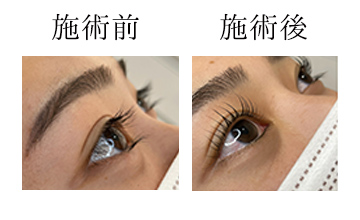 ROAK（ローク）施術例　まつげパーマ例2