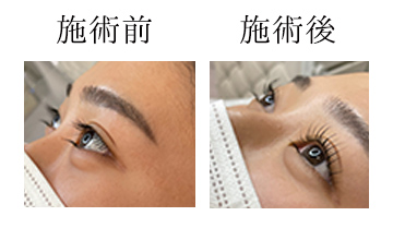 ROAK（ローク）施術例　まつげパーマ例3