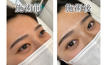 ROAK（ローク）施術例　まつげパーマ例4